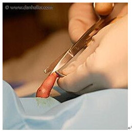 小孩割皮包的手术过程图片
