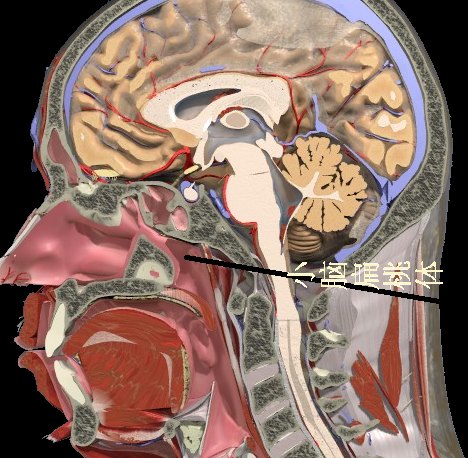 小脑扁桃体位置图片