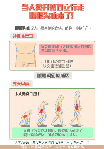 腹股沟疝气原因图片