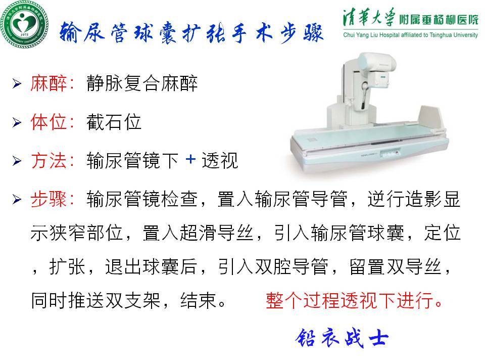 輸尿管狹窄可以實施輸尿管球囊擴張