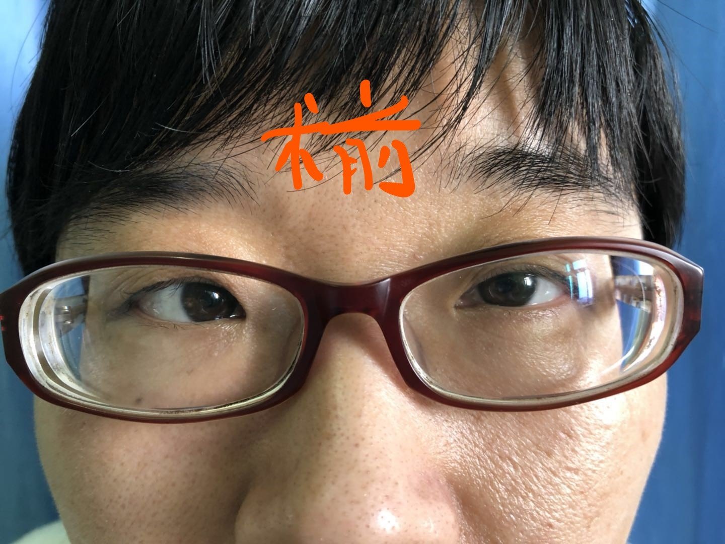 扬州近视激光哪家医院好_扬州近视眼手术价格一览表_扬州近视激光手术多少钱