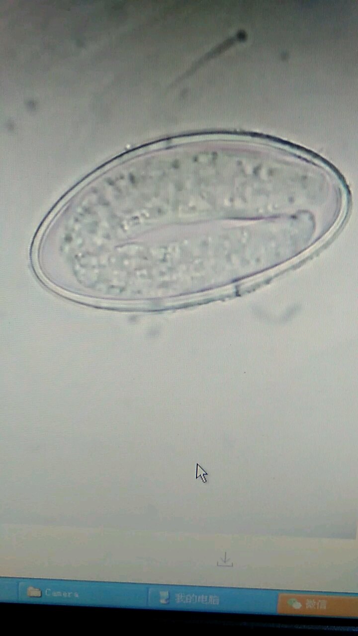 饶虫卵显微镜下图片图片