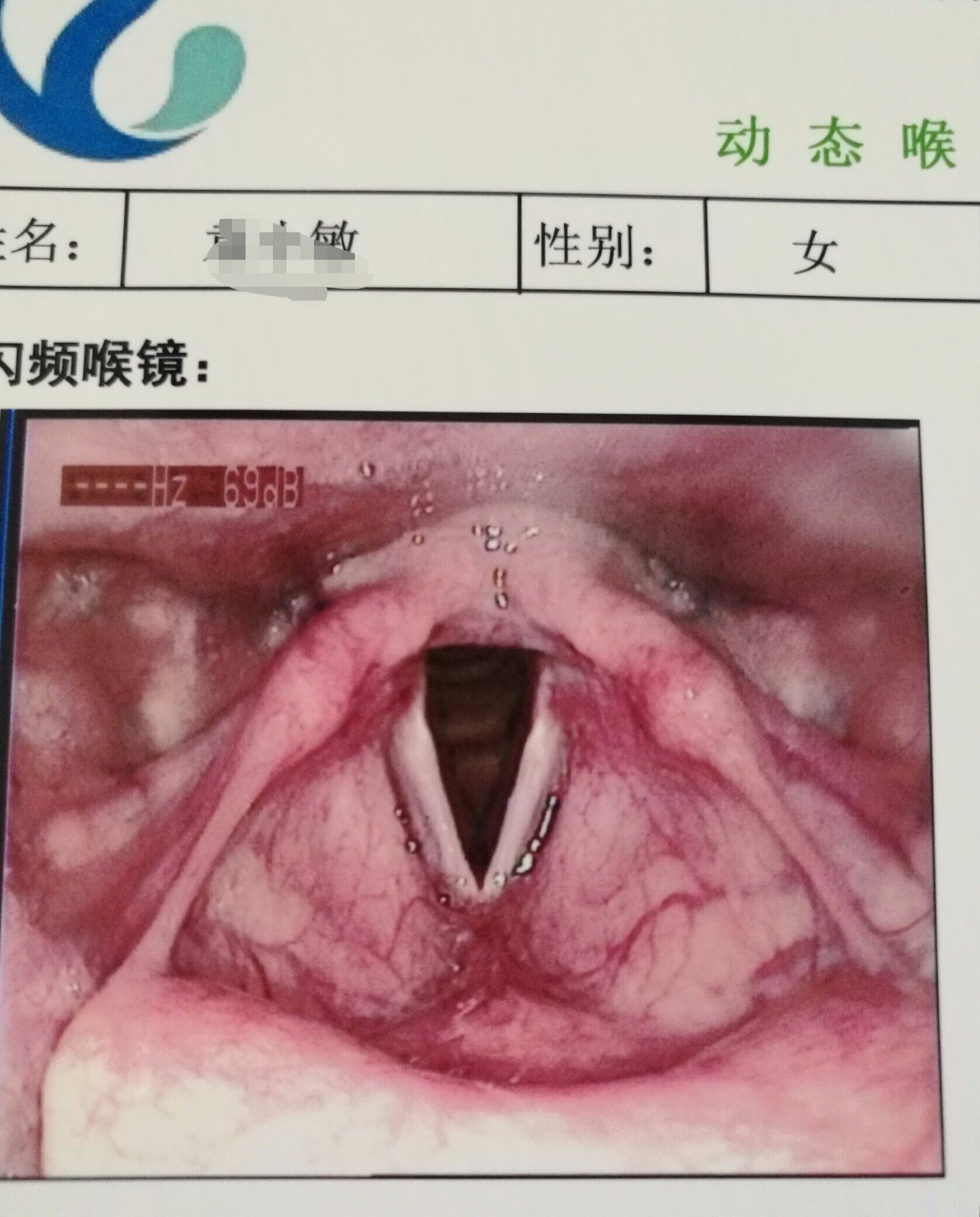 喉部肿物？声带息肉？来体验这个清晰、无创的喉部检查-上杭县医院