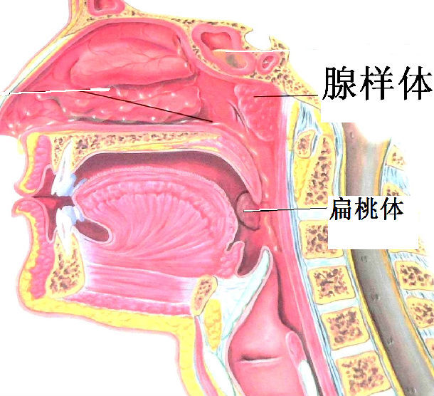 腺样体手术过程图图片