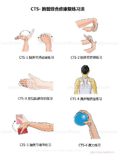 cts腕管综合症康复练习法