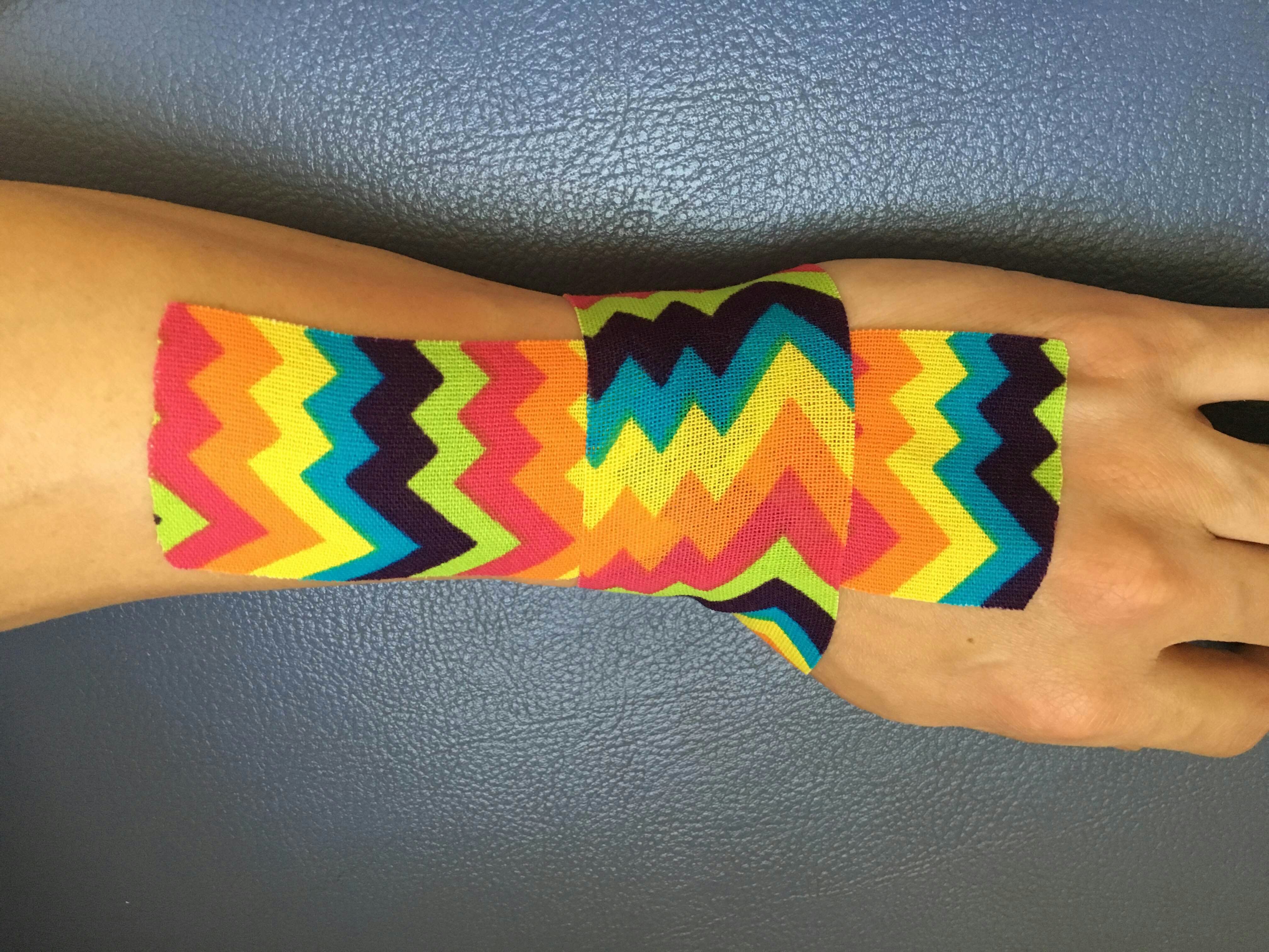 肌内效贴案例展示～治疗手腕疼痛 - 好大夫在线