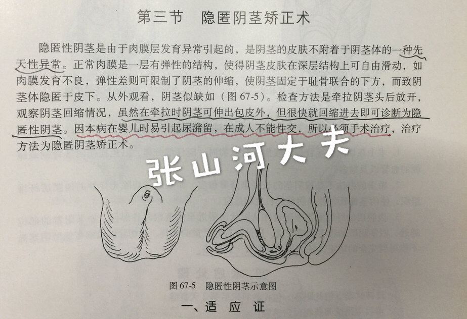 隐匿阴茎当作包皮过长的后果(附真实图片) - 好大夫在线