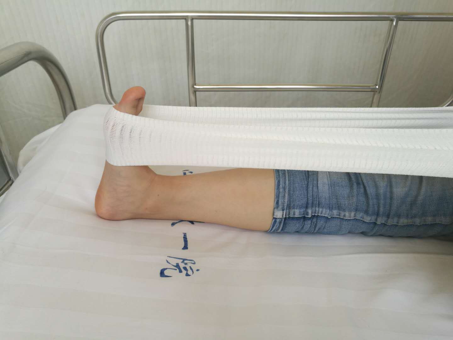 足底筋膜炎的保守治疗方法