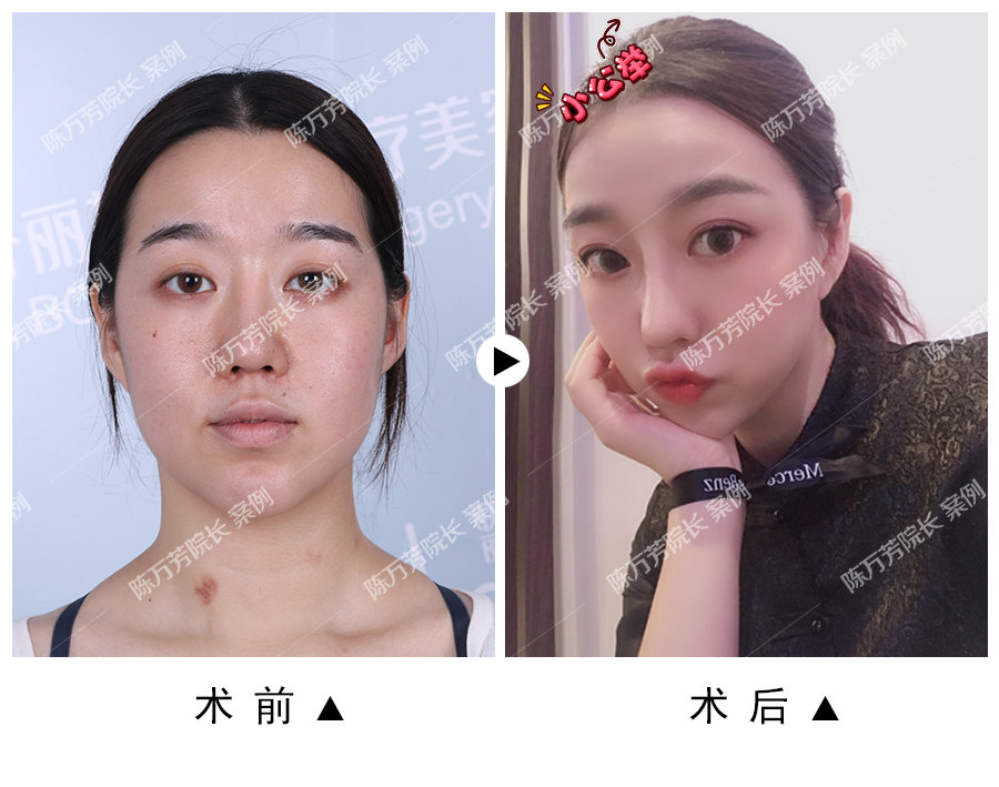 脸部肌肉下垂怎么办 w4YBAFw9TkiAABX4AAG8dCgvLVo995.jpg?_ms_=dcf5
