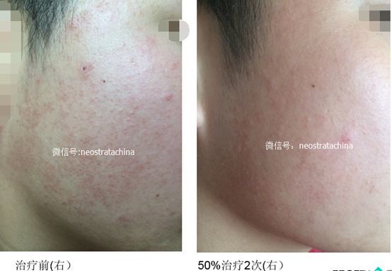 暂无