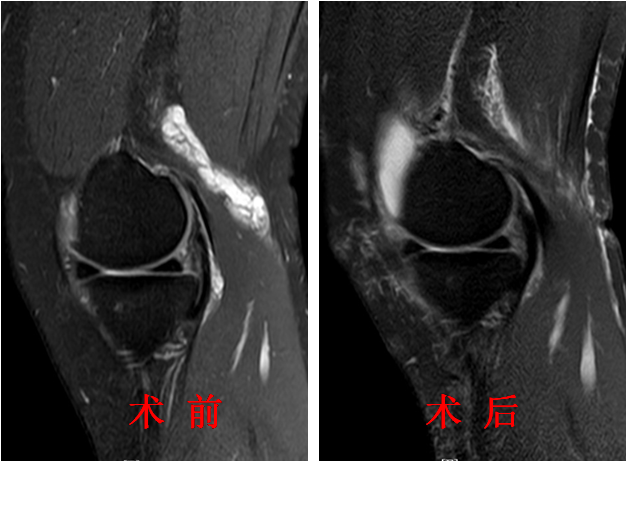 术前术后图片.png