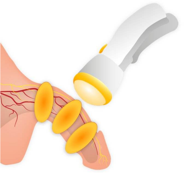 1567343773388799.png v4YBAFvOyy6AI_aVAAIus6gQp3U002.png