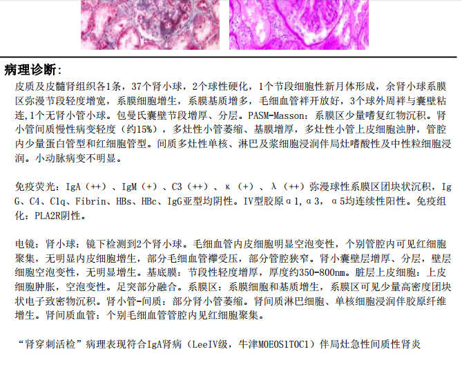 间质性肾炎 www.haodf.com