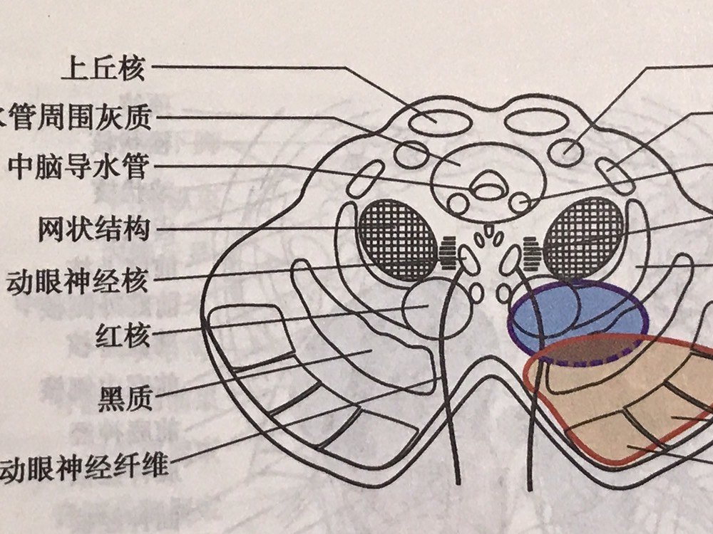 中脑导水管解剖图片