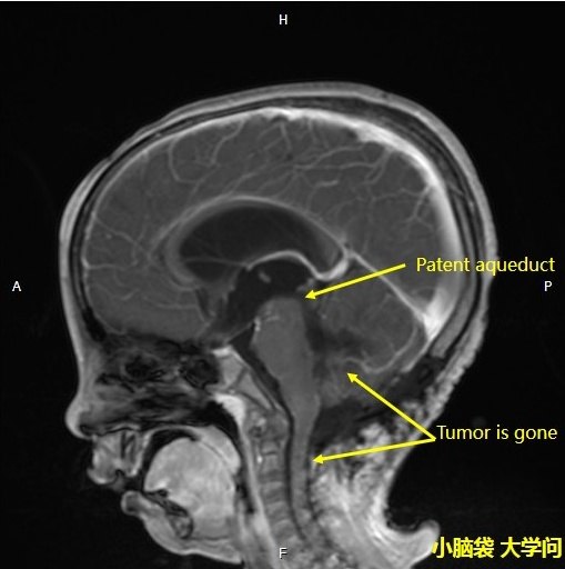 暂无