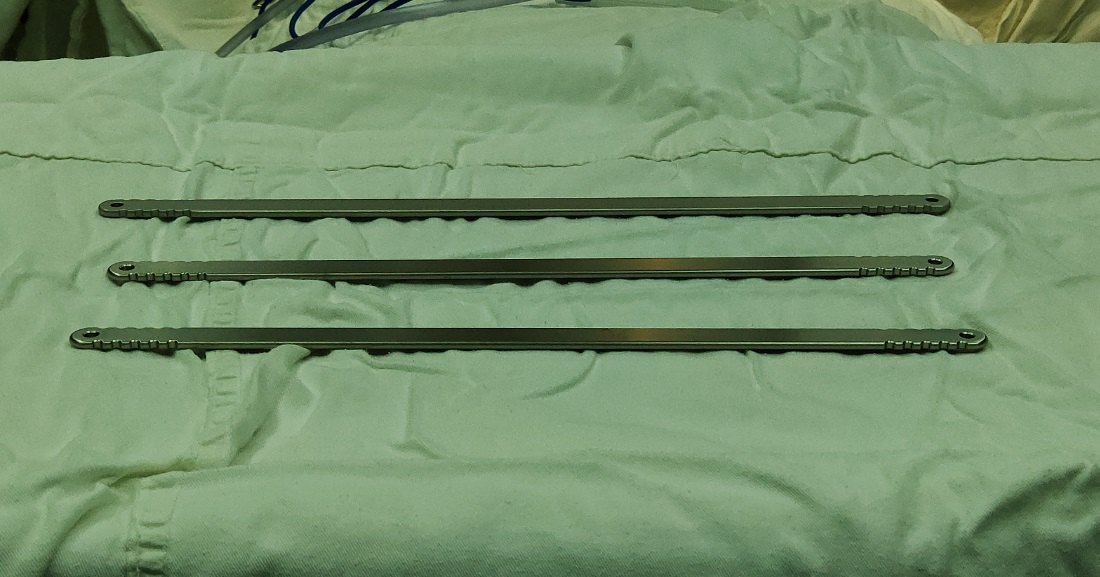 今天的bleedingless手术: 3条钢板,无一滴出 - 好大夫在线