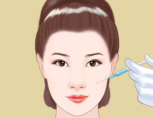 玻尿酸注射,还您一个青春容颜 - 好大夫在线