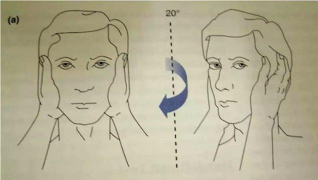 romberg试验:bvp患者可呈阳性.