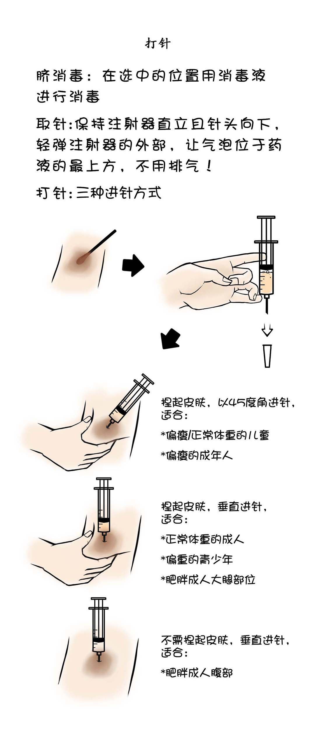 乙肝疫苗注射部位图片