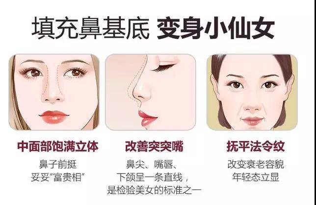 鼻基底填充 改善鞋拔子脸 凸嘴 法令纹 隆鼻 隆鼻治疗方法 鼻基底填充 改善鞋拔子脸 凸嘴 法令纹 隆鼻 隆鼻治疗方法