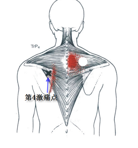 肩胛下区示意图图片