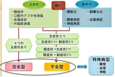 behcet病的诊断与治疗