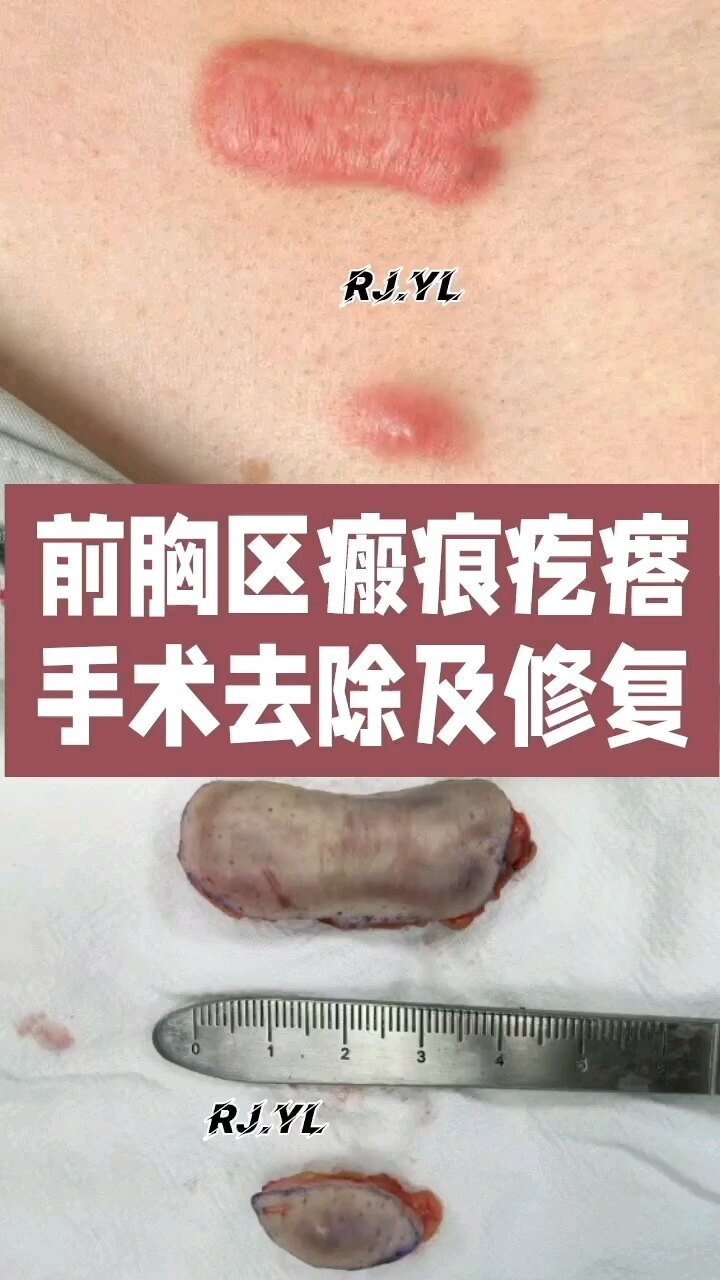視頻封面
