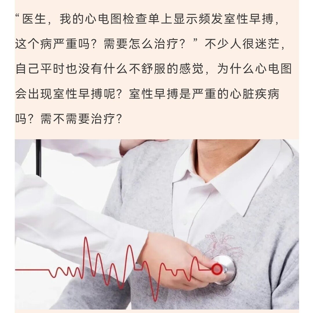 我的早搏需要治疗么？