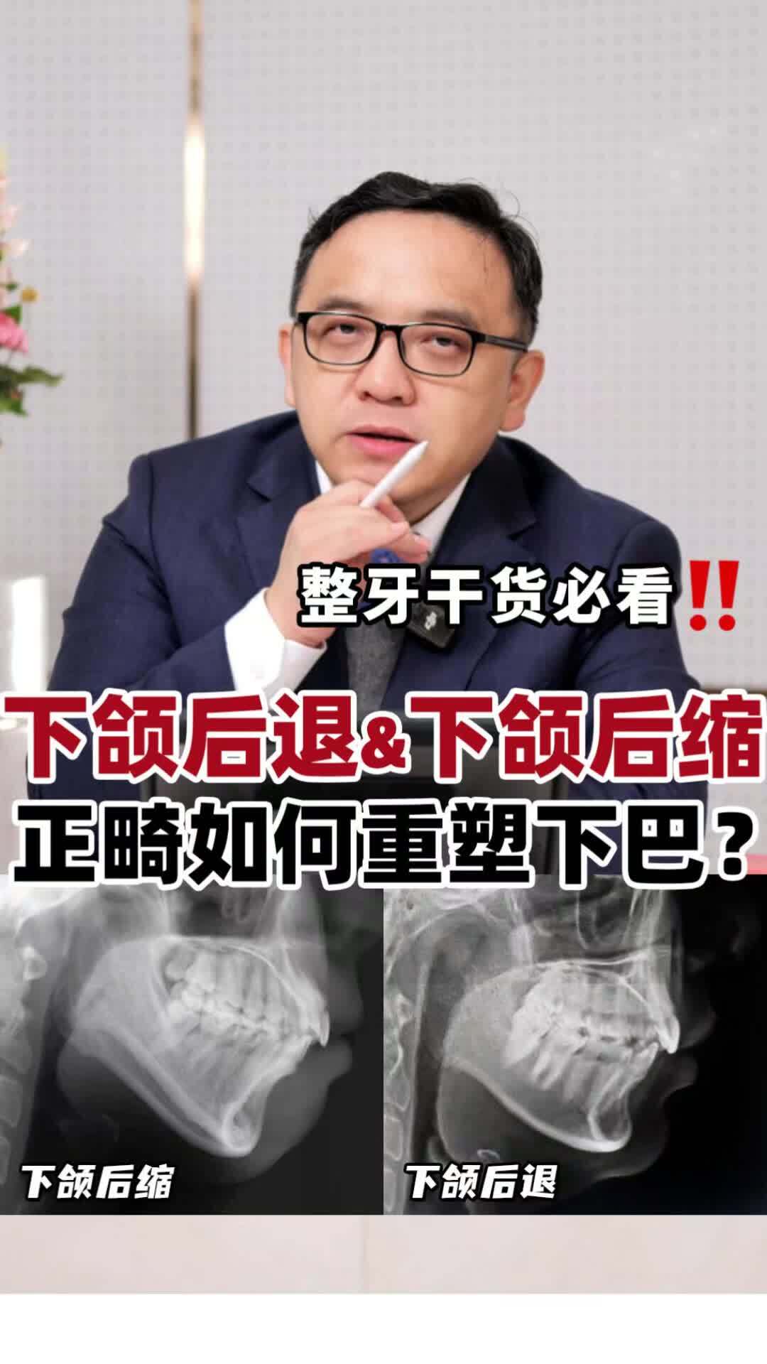 視頻封面