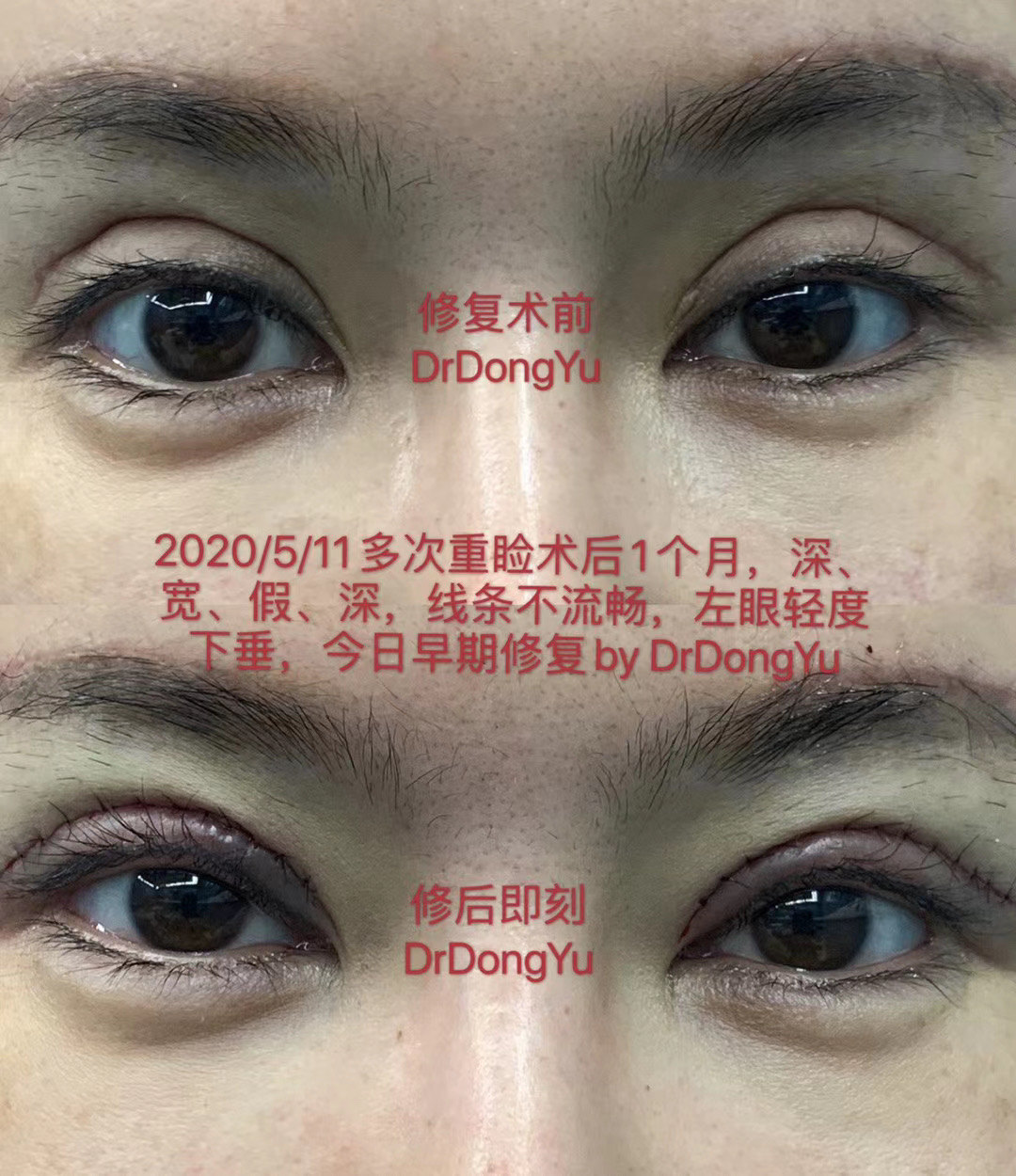 暂无