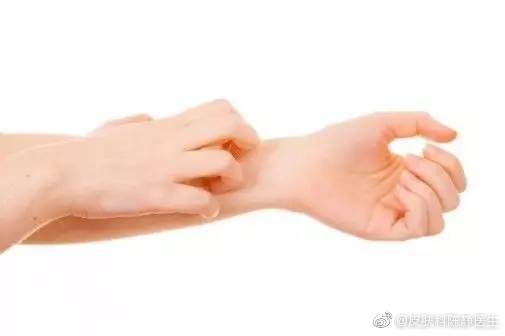 特应性皮炎患者要避免搔抓患处