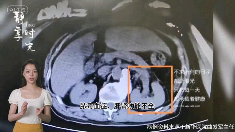 視頻封面