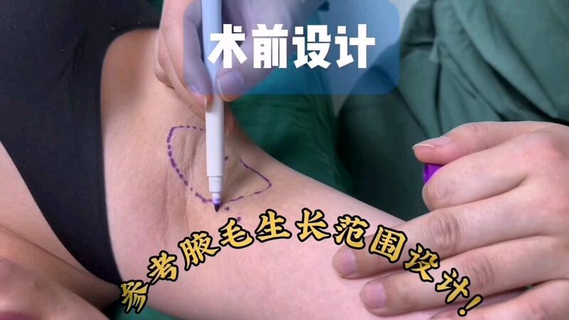 視頻封面