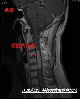 圖文圖片