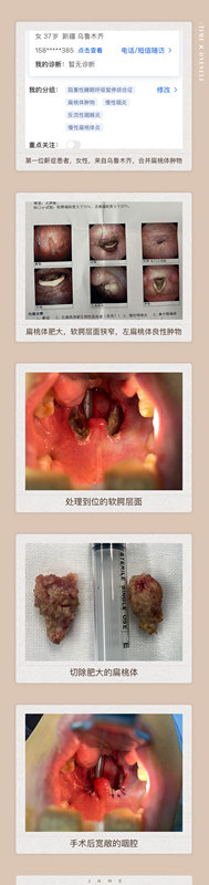 圖文圖片