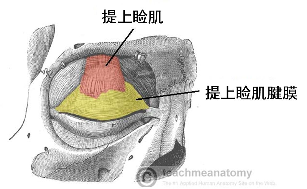 手术方式:提上睑肌腱膜改良离断术