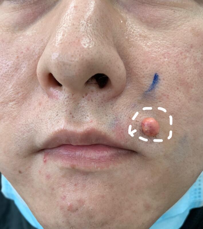 圖文圖片