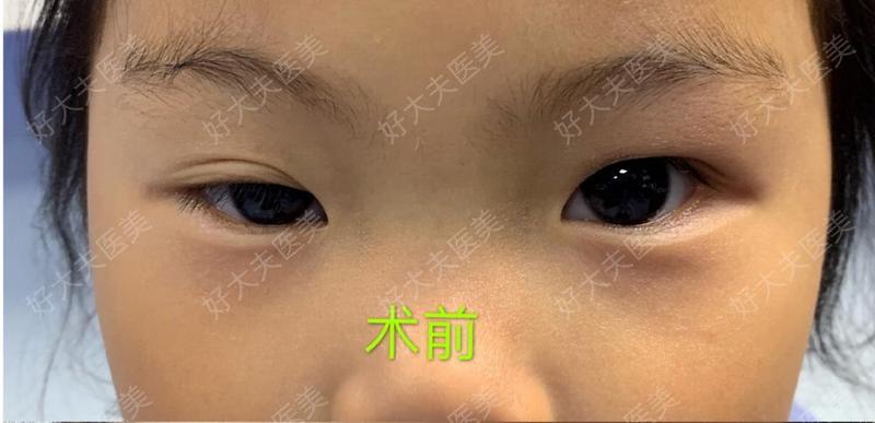 圖文圖片