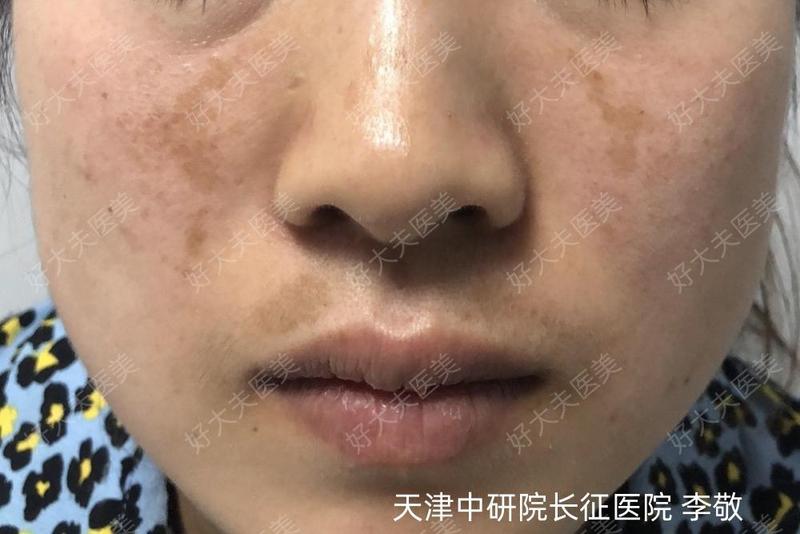 圖文圖片