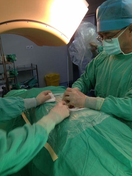 手术中穿刺过程