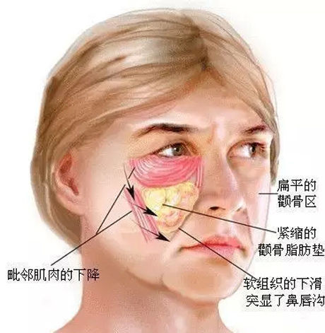 怎么改善法令纹提升效果 yYYBAFvcJ3-AUk18AACjNWX98z0877.jpg?_ms_=88c9