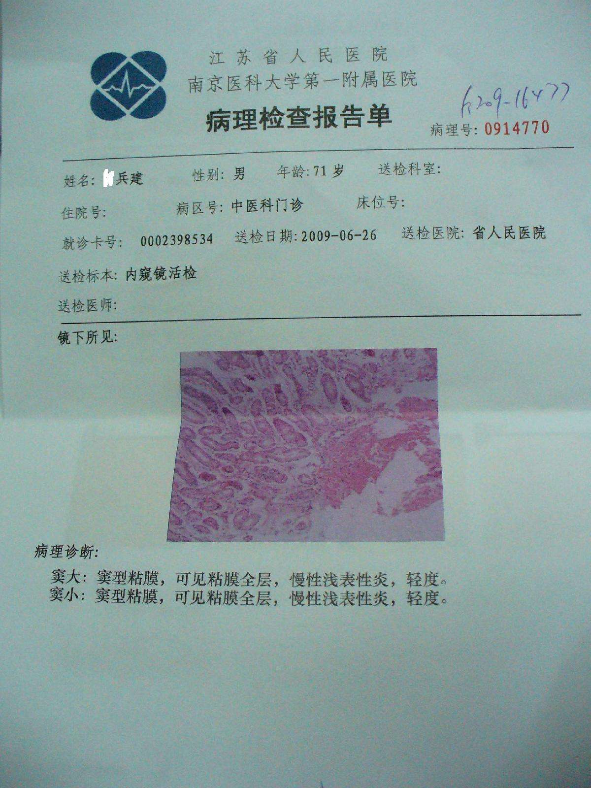 肠上皮化生逆转病理报告 - 好大夫在线