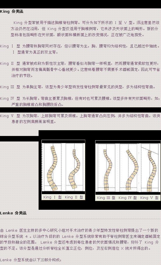 脊柱侧弯lenke分型图谱图片