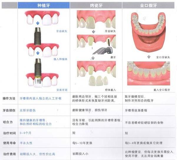 沟牙和管牙的区别图片