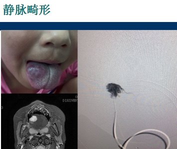暂无