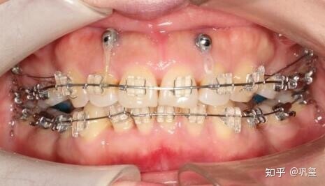 1539655078612936.jpg v2-aa5a55da126b888245662d826c68326a_r.jpg