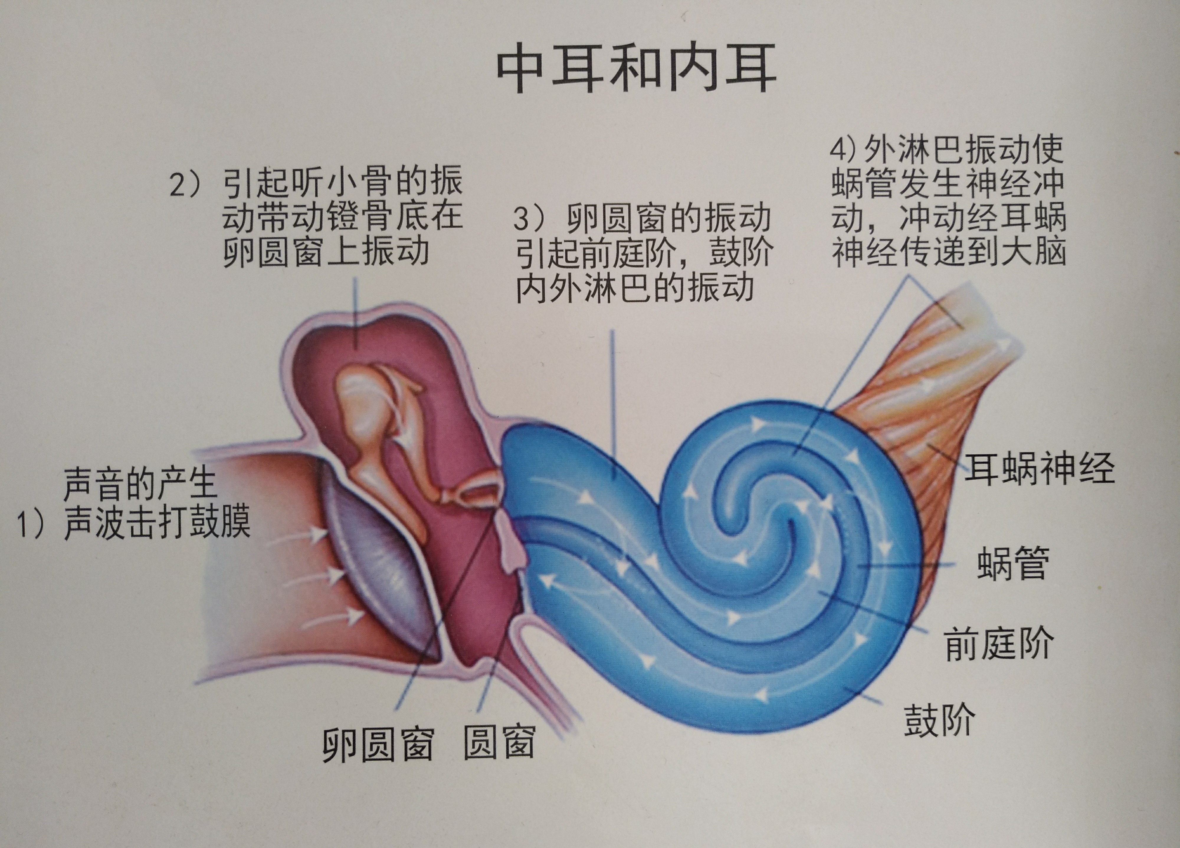 中耳炎是怎么引起的图片