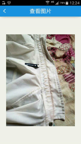 极为罕见的血汗症