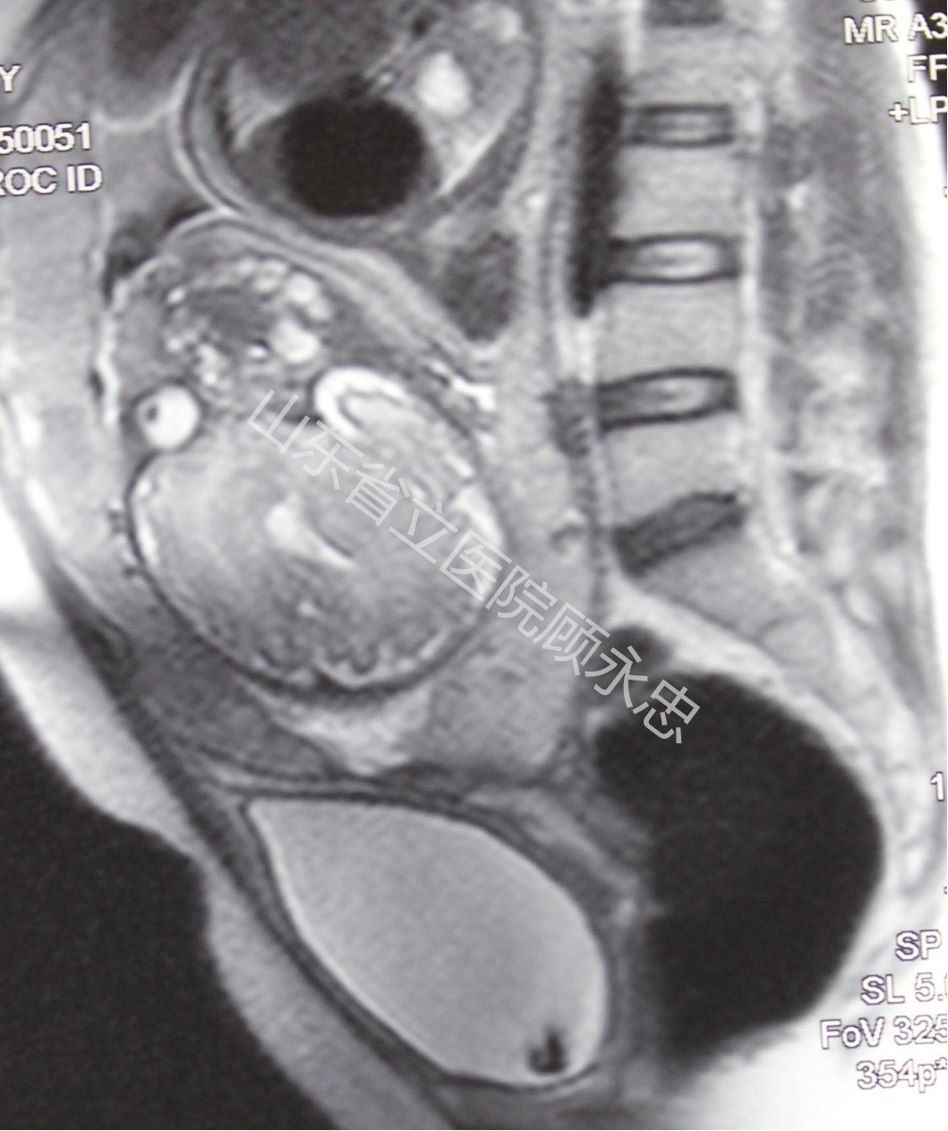 mmexport1560081246879.jpg