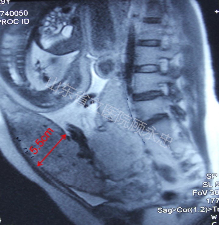 mmexport1560081242552.jpg